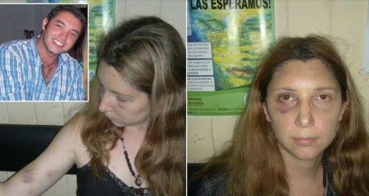 Odontóloga denunció ser secuestrada, torturada y violada por su novio
