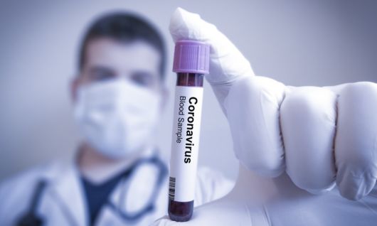 Corrientes: 91 nuevos casos de coronavirus en la provincia
